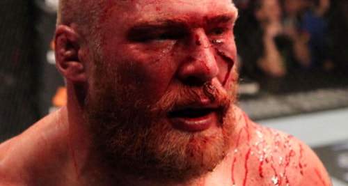 Brock Lesnar beard soaked in blood