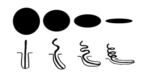 The following image illustrates the different forms of hair follicles according to the different variations of hair structures.